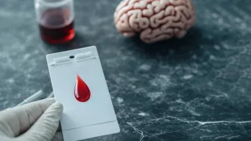 Testi i gjakut mund të diagnostikojë Alzheimerin: Studim i ri po hulumton testet me shpim gishti