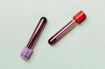 Studim: Testi i thjeshtë i gjakut mund të parashikojë se kush ka më shumë gjasa të jetojë më gjatë