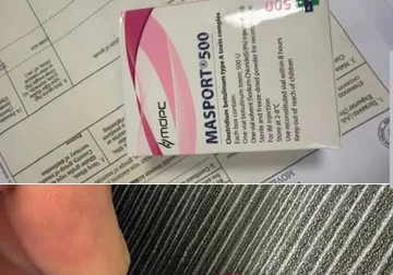 Zbulohet mall i padeklaruar me vlerë mbi 26 mijë euro në Ferizaj