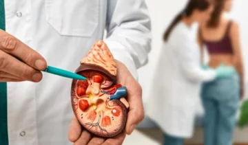 Nga çka krijohen gurët në veshka?